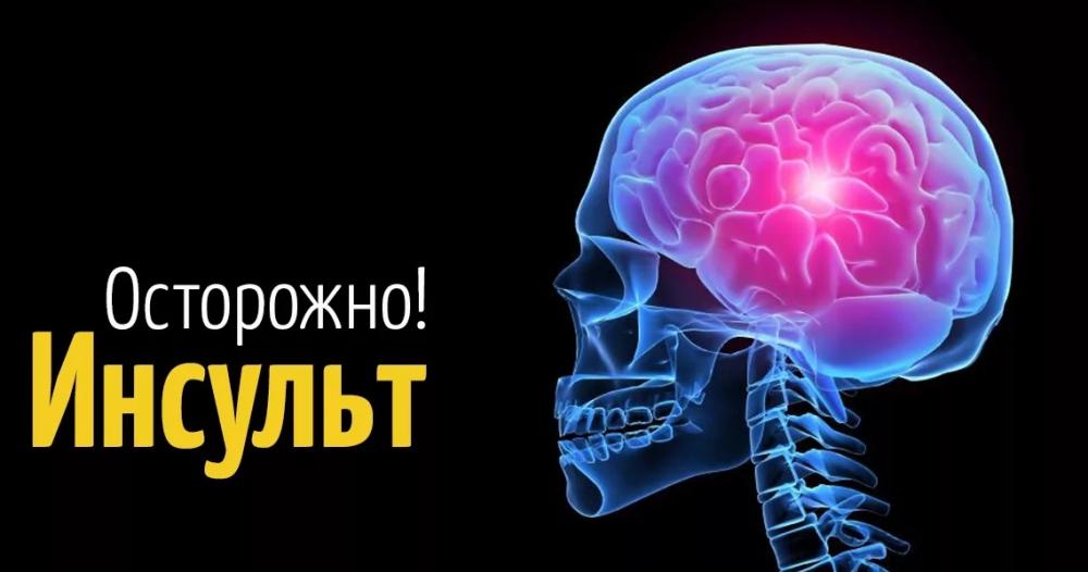 Топ 5 признаков инсульта