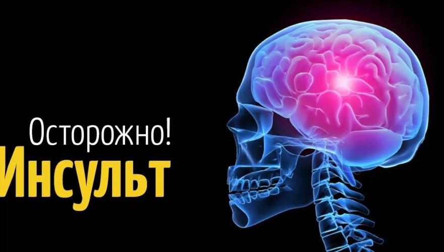 Топ 5 признаков инсульта